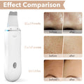 Ultrasonic Skin Facial Scrubber Pore Cleaner Blackhead Remover