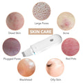Ultrasonic Skin Facial Scrubber Pore Cleaner Blackhead Remover